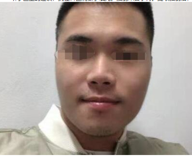 东北国际医院整形美容科自体脂肪填充面部面诊