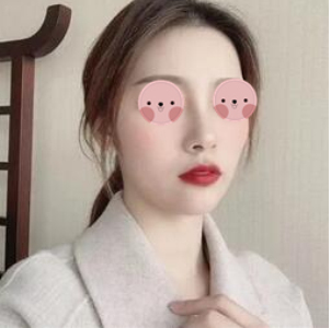 西安俪时代医美整形鼻部手术手术案例分享