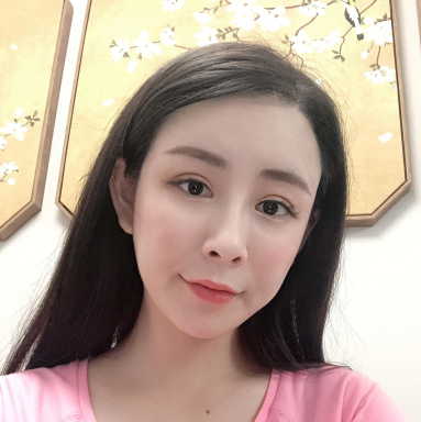 上海爱美者自体脂肪丰额头术后果分享