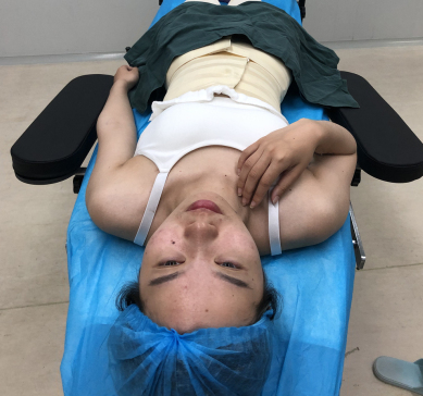 南京美贝尔整形腰腹吸脂案例赏析：恢复果