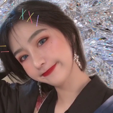美女在杭州薇琳温科磊医生隆鼻果附图分享