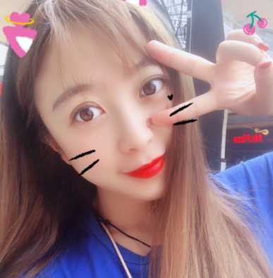 南京艺星做的双眼皮果怎么样？