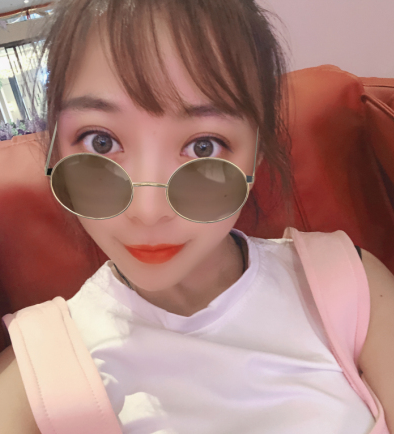 南京艺星做的双眼皮果怎么样？