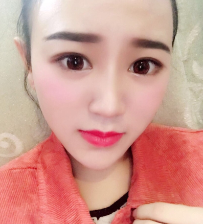 激光美肤祛斑怎样?妹纸佳人医美激光美肤术后分享