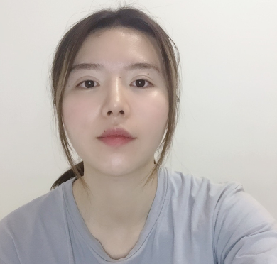成都MM格莱丽医美光子嫩肤术后果分享