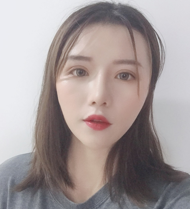 成都MM格莱丽医美光子嫩肤术后果分享