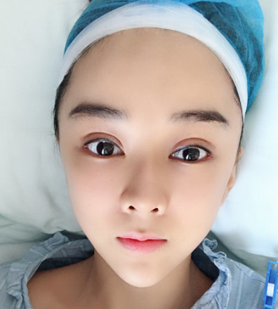 深圳艾妍徐荣阳怎样?妹纸丰唇隆鼻分享