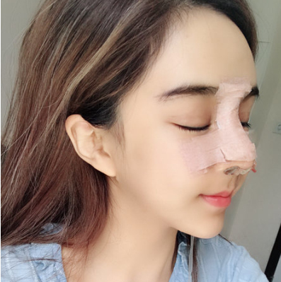 深圳艾妍徐荣阳怎样?妹纸丰唇隆鼻分享