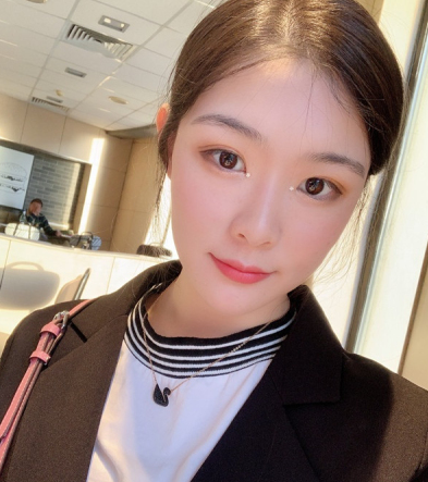 再生未来医美靠谱吗?MM热玛吉术后分享