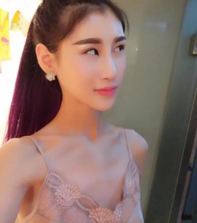 黄名斗医生自体隆胸果好不？有隆胸案例吗？