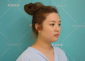 唯颜医美怎么样?医生马永奇吸脂案例分享