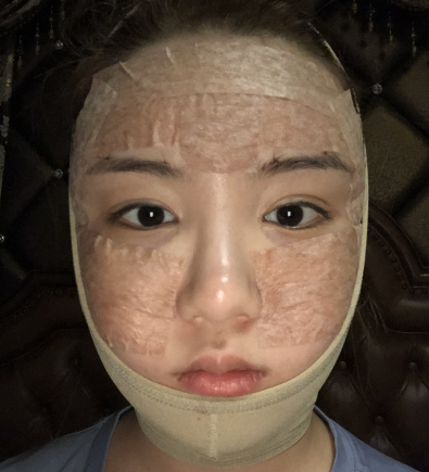唯颜医美怎么样?医生马永奇吸脂案例分享