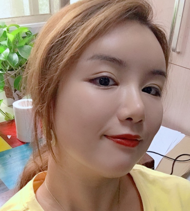 唯颜医美怎么样?医生马永奇吸脂案例分享