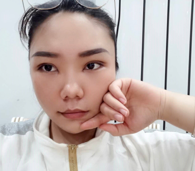 郑州都市风韵李广萍医生眼部手术果好吗