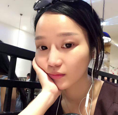 重庆当代整形美容医院膨体隆鼻案例！
