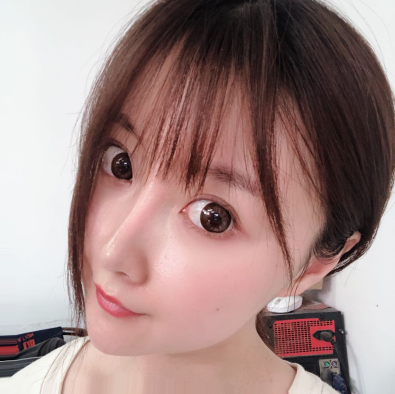 上海首尔丽格医美整形医生石润颧骨降低案例