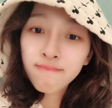 佛山华美整形水光补水可靠吗？蒋瑜医生案例果
