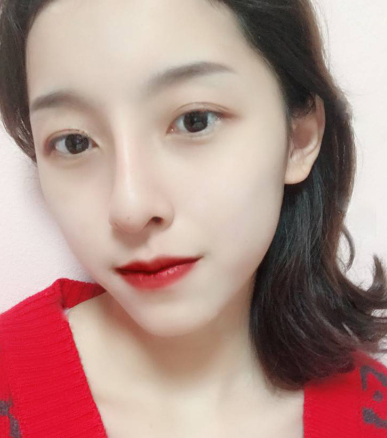 佛山华美整形水光补水可靠吗？蒋瑜医生案例果