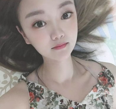 北京画美医院医生崔春雷超激光美肤果如何？案例