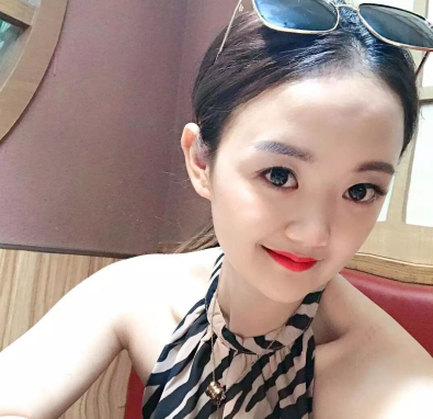 北京画美医院医生崔春雷超激光美肤果如何？案例