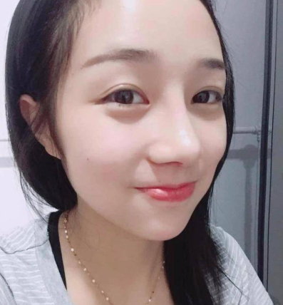 长沙艾依美刘湘做鼻部手术修复怎么样？案例
