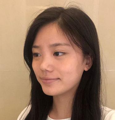 武汉新至美医疗美容聂祝锋医生鼻部手术案例分享