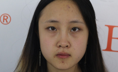重庆当代整形怎么样?王旭明隆鼻好不好?