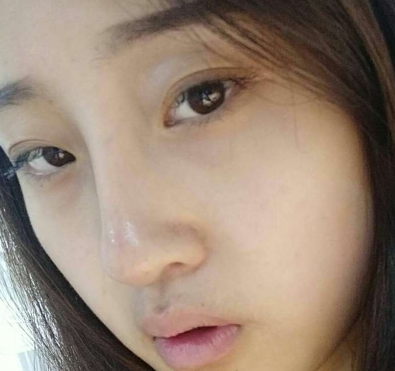重庆当代整形怎么样?王旭明隆鼻好不好?