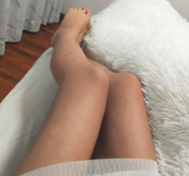 重庆时光整形医院咋样?大腿吸脂可靠吗?