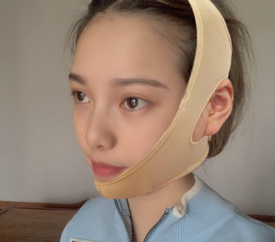 深圳恒生(嘉美)肖添有下颌角磨骨案例分享