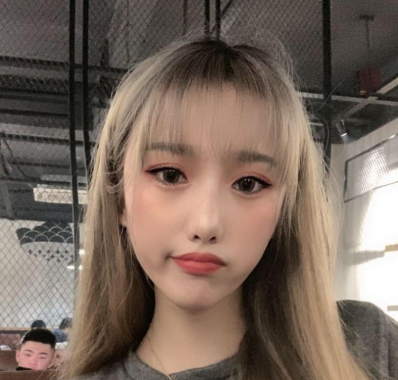 深圳恒生(嘉美)肖添有下颌角磨骨案例分享