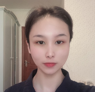 上海仁爱刘先超做下颌角+颧骨内推怎么样?案例