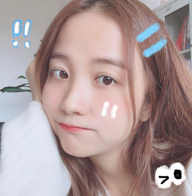 昆明医科大学第二附属医院能做双眼皮吗?案例