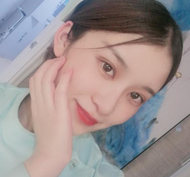 昆明医科大学第二附属医院能做双眼皮吗?案例