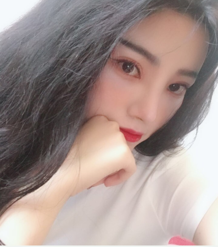昆明美伊莱医疗医生周诚鼻部手术案例分享!