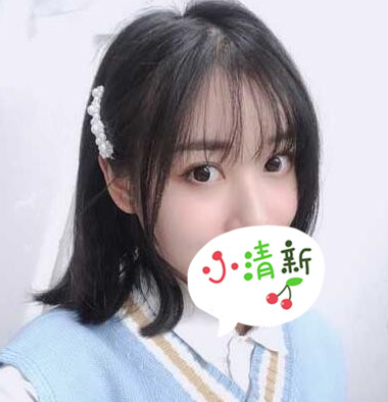 玉溪吴氏嘉美医美刘勤做双眼皮怎么样?案例