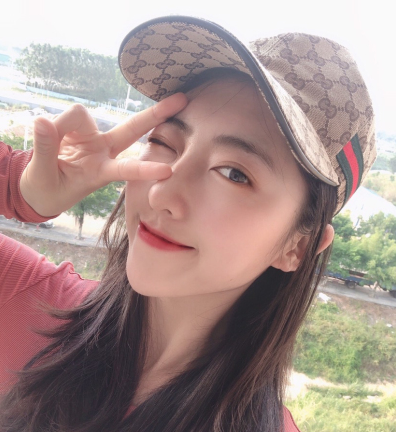 广东韩妃医疗美容医院程宁新鼻部手术案例分享
