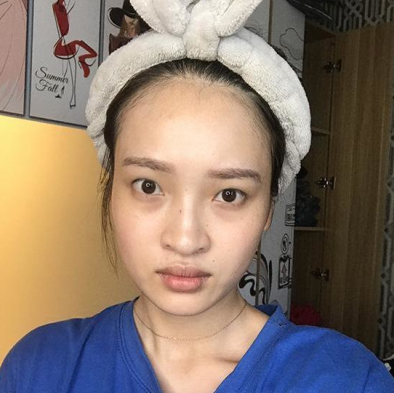 宁波唯格整形美容医院做双眼皮可靠不?点评