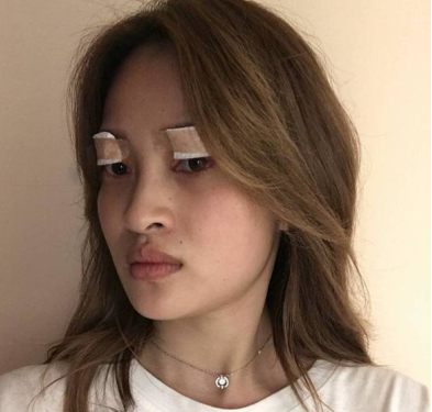 宁波唯格整形美容医院做双眼皮可靠不?点评