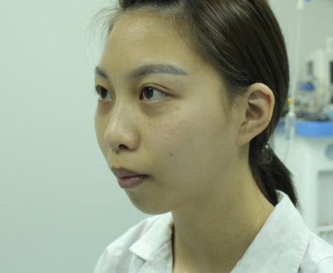 宁波雅韩宁悦医疗美容口碑如何?案例|点评