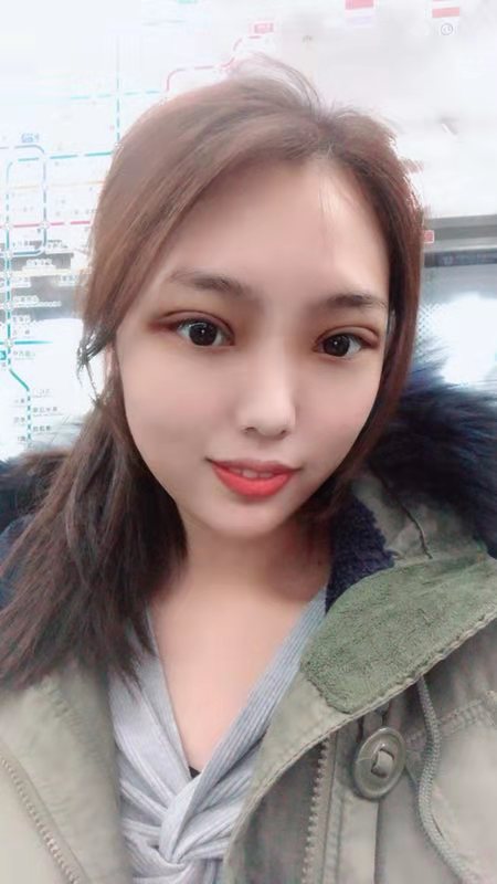 北京延世医疗美容诊所双眼皮技术怎么样?案例