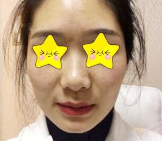 葛志鑫和任东鼻部手术谁做的更好?案例|点评