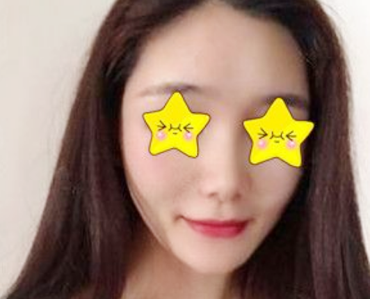 葛志鑫和任东鼻部手术谁做的更好?案例|点评