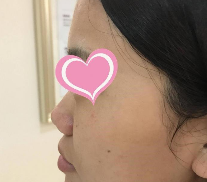 联合丽格的范荣杰鼻部手术技术怎么样?案例|点评