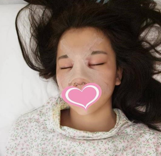 联合丽格的范荣杰鼻部手术技术怎么样?案例|点评