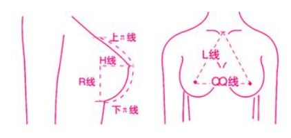 自体脂肪隆胸你真的了解吗?