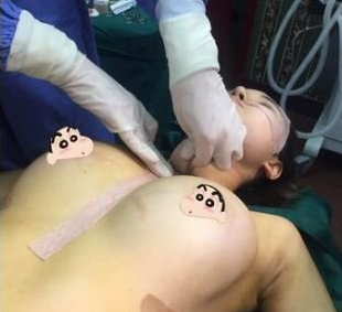 上海九院哪个医生隆胸技术好?【盘点|点评】