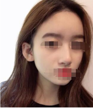 上海华美整形李健做鼻子怎么样?【盘点|点评】