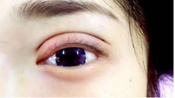 长沙鹏爱整形医院怎么样?