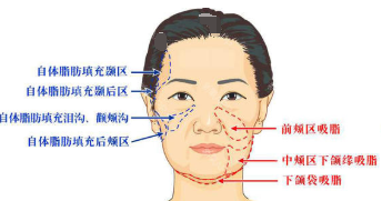 深圳美莱整形医院怎么样?
